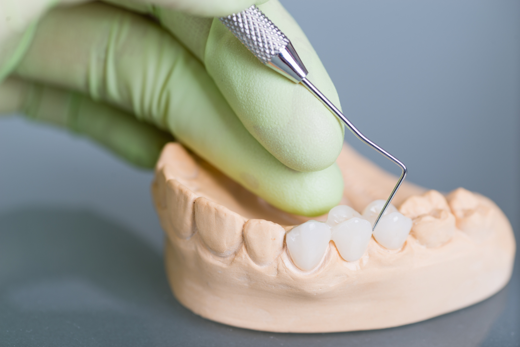 types prothèses dentaires - Clinique Dentaire Charles Trottier