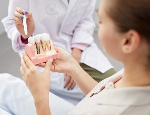 Dental implants: prices, procedures and answers to your questions