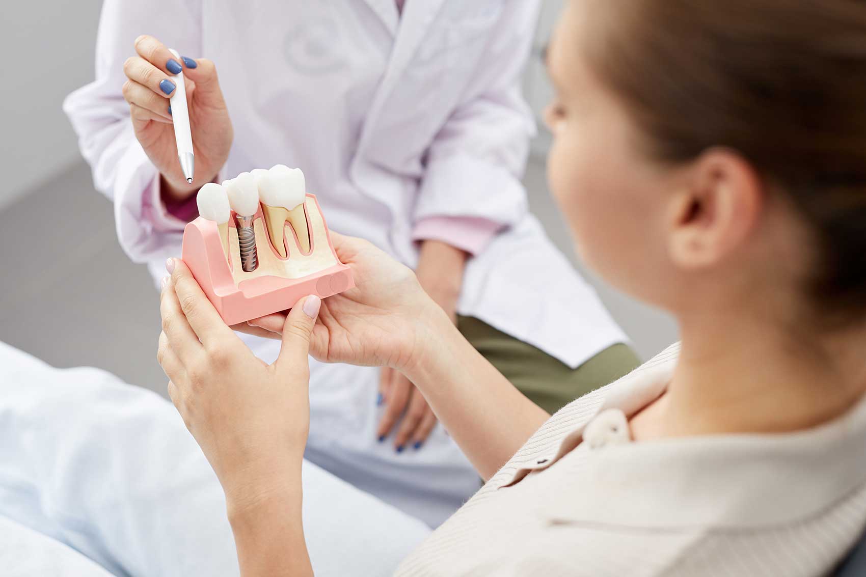 procédure d'implant dentaire expliquée
