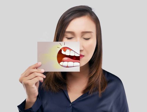 Abcès dentaire ou gingival: Causes et traitement