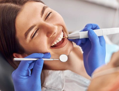 Détartrage dentaire: Faut-il nécessairement aller chez le dentiste?