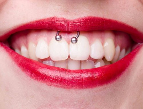 Piercing smiley et piercing dentaire: Conseils de votre dentiste