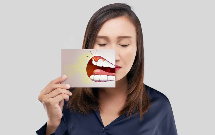 abcès dentaire ou gingival